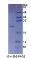 PLCB3 Protein - Recombinant  Phospholipase C Beta 3, Phosphoinositide Specific By SDS-PAGE