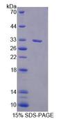 PLCD1 Protein - Recombinant Phospholipase C Delta 1 (PLCd1) by SDS-PAGE