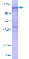 PLCD4 Protein - 12.5% SDS-PAGE of human PLCD4 stained with Coomassie Blue