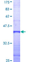 PLCD4 Protein - 12.5% SDS-PAGE Stained with Coomassie Blue.