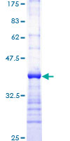PLCG1 Protein - 12.5% SDS-PAGE Stained with Coomassie Blue
