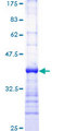 PLCG1 Protein - 12.5% SDS-PAGE Stained with Coomassie Blue