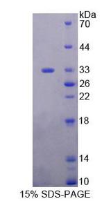 PLCH1 Protein - Recombinant Phospholipase C Eta 1 (PLCh1) by SDS-PAGE