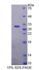 PLCH2 Protein - Recombinant Phospholipase C Eta 2 (PLCh2) by SDS-PAGE