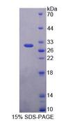 PLCH2 Protein - Recombinant Phospholipase C Eta 2 (PLCh2) by SDS-PAGE