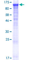 PLCL2 Protein - 12.5% SDS-PAGE of human PLCL2 stained with Coomassie Blue