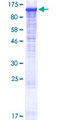 PLCL2 Protein - 12.5% SDS-PAGE of human PLCL2 stained with Coomassie Blue