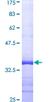 PLCL2 Protein - 12.5% SDS-PAGE Stained with Coomassie Blue.