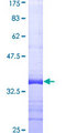 PLCL2 Protein - 12.5% SDS-PAGE Stained with Coomassie Blue.