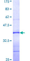 PLCXD1 Protein - 12.5% SDS-PAGE Stained with Coomassie Blue.