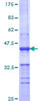 PLD1 / Phospholipase D1 Protein - 12.5% SDS-PAGE Stained with Coomassie Blue