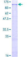 PLD2 / Phospholipase D2 Protein - 12.5% SDS-PAGE of human PLD2 stained with Coomassie Blue