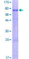 PLD4 / Phospholipase D4 Protein - 12.5% SDS-PAGE of human PLD4 stained with Coomassie Blue