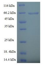 PLD4 / Phospholipase D4 Protein