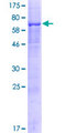 PLD5 / Phospholipase D5 Protein - 12.5% SDS-PAGE of human PLD5 stained with Coomassie Blue