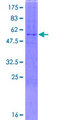 PLD6 / Phospholipase D6 Protein - 12.5% SDS-PAGE of human LOC201164 stained with Coomassie Blue