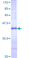 PLEC / Plectin Protein - 12.5% SDS-PAGE Stained with Coomassie Blue.