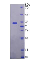 PLEC / Plectin Protein - Recombinant  Plectin By SDS-PAGE
