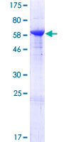 PLEK / Pleckstrin Protein - 12.5% SDS-PAGE of human PLEK stained with Coomassie Blue