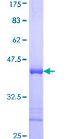 PLEK / Pleckstrin Protein - 12.5% SDS-PAGE Stained with Coomassie Blue.