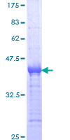 PLEK2 Protein - 12.5% SDS-PAGE Stained with Coomassie Blue.