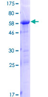 PLEKHA3 Protein - 12.5% SDS-PAGE of human PLEKHA3 stained with Coomassie Blue
