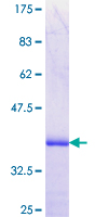 PLEKHA3 Protein - 12.5% SDS-PAGE Stained with Coomassie Blue.