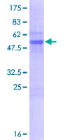 PLEKHB2 Protein - 12.5% SDS-PAGE of human PLEKHB2 stained with Coomassie Blue