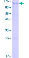 PLEKHG6 Protein - 12.5% SDS-PAGE of human PLEKHG6 stained with Coomassie Blue