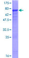 PLEKHM2 / SKIP Protein - 12.5% SDS-PAGE of human PLEKHM2 stained with Coomassie Blue