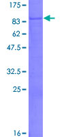 PLEKHO2 Protein - 12.5% SDS-PAGE of human pp9099 stained with Coomassie Blue