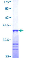 PLEKHO2 Protein - 12.5% SDS-PAGE Stained with Coomassie Blue.