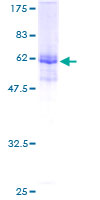 PLEKHS1 / C10orf81 Protein - 12.5% SDS-PAGE of human C10orf81 stained with Coomassie Blue