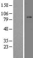 PLG / Plasmin / Plasminogen Protein - Western validation with an anti-DDK antibody * L: Control HEK293 lysate R: Over-expression lysate