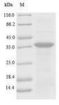 PLG / Plasmin / Plasminogen Protein - (Tris-Glycine gel) Discontinuous SDS-PAGE (reduced) with 5% enrichment gel and 15% separation gel.