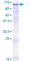 PLG / Plasmin / Plasminogen Protein - 12.5% SDS-PAGE of human PLG stained with Coomassie Blue