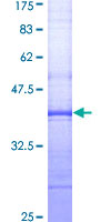 PLG / Plasmin / Plasminogen Protein - 12.5% SDS-PAGE Stained with Coomassie Blue.