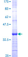 PLGLB2 / PLGLB1 Protein - 12.5% SDS-PAGE Stained with Coomassie Blue.