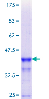 PLIN1 / Perilipin Protein - 12.5% SDS-PAGE Stained with Coomassie Blue.