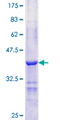 PLIN2 / ADFP / Adipophilin Protein - 12.5% SDS-PAGE Stained with Coomassie Blue.