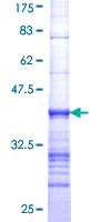 PLIN2 / ADFP / Adipophilin Protein - 12.5% SDS-PAGE Stained with Coomassie Blue.