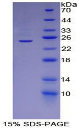 PLIN2 / ADFP / Adipophilin Protein - Recombinant Adipose Differentiation Related Protein By SDS-PAGE