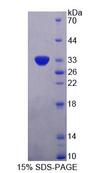 PLIN4 / S3-12 Protein - Recombinant Perilipin 4 (PLIN4) by SDS-PAGE