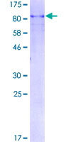 PLK1 / PLK-1 Protein - 12.5% SDS-PAGE of human PLK1 stained with Coomassie Blue