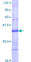 PLK1 / PLK-1 Protein - 12.5% SDS-PAGE Stained with Coomassie Blue.