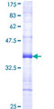 PLK4 / SAK Protein - 12.5% SDS-PAGE Stained with Coomassie Blue.