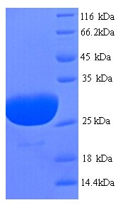 PLN / Phospholamban Protein