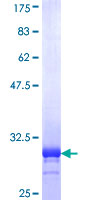 PLN / Phospholamban Protein - 12.5% SDS-PAGE Stained with Coomassie Blue.