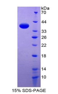 PLN / Phospholamban Protein - Recombinant Phospholamban By SDS-PAGE