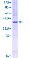 PLOD / PLOD1 Protein - 12.5% SDS-PAGE Stained with Coomassie Blue.